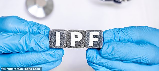 Ipilimumab blocks the CTLA-4 protein ¿ which suppresses the immune system ¿ to allow the body to better recognise and attack diseased cells (file image)
