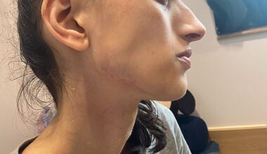 A woman 'close to death' due to severe anorexia has turned her life around to study medicine at university - and reach the semi finals of Miss England