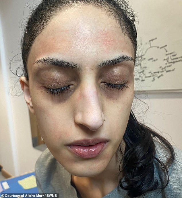 Her weight plummeted to dangerous levels and Alisha claims one specialist said she was 'the most unwell patient' he had ever seen