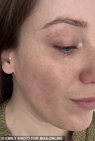 After taking Equi London Beauty Formula for two weeks