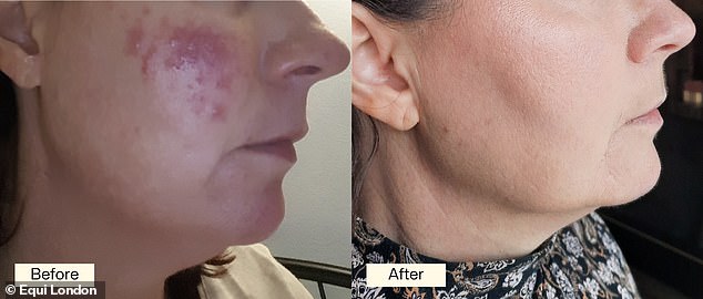 Reviewer results: Many shoppers echo the same results, with reviews raving that their 'skin, nails and hair are in better condition than in my twenties' after taking Beauty Formula.