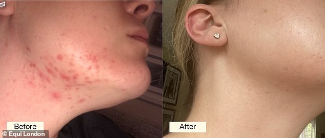 Before and after: Hundreds of shoppers have turned to Equi London’s award-winning Beauty Formula, calling it 'the best supplement I've ever tried' and 'an instant hit'