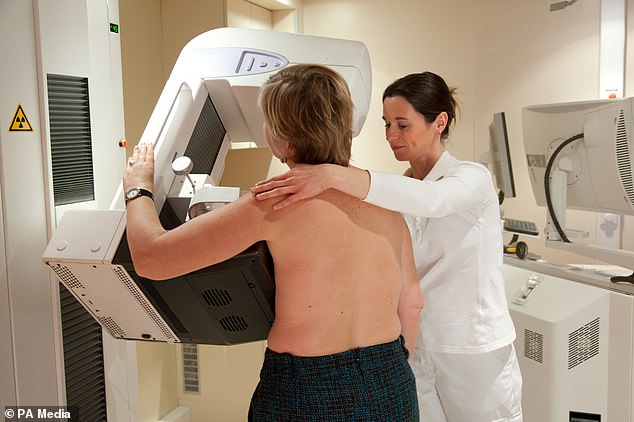 The Government has faced calls for men to be allowed to conduct mammograms amid workforce shortages
