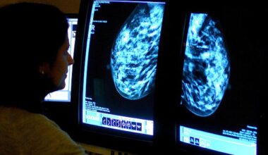 Experts from the Society of Radiographers (SoR) have suggested that male health workers should be allowed to perform mammograms to help tackle staff shortages