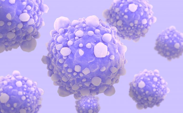 pancreatic cancer cells
