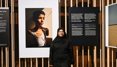 A woman stands next to a photo of a boy with mutilated arms.