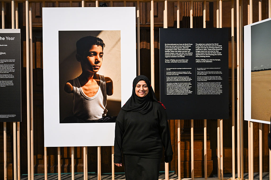A woman stands next to a photo of a boy with mutilated arms.