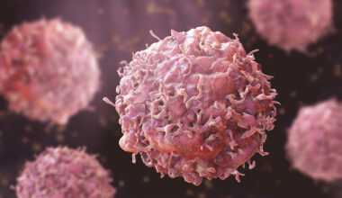 Inherited DNA as Well as Tumor Mutations Drive Cancer