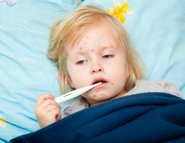 Measles could become endemic again in the United States