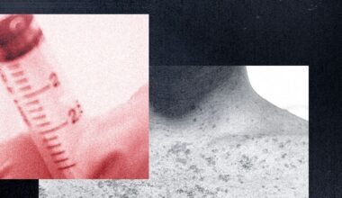 Anti-Vaxxers Are Grifting Off the Measles Outbreak—and Claim a Bioweapon Caused It