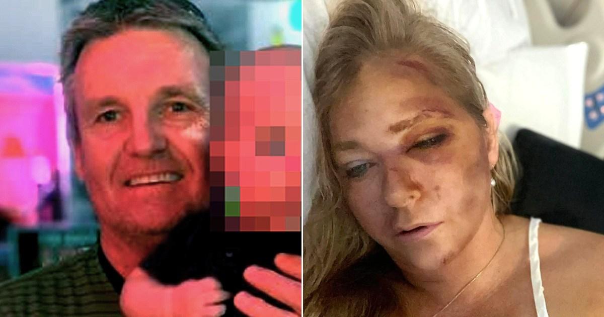 Bus driver in Virginia Giuffre crash gives his side of the story | News World