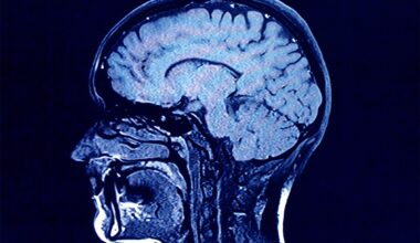Creatine for Brain Health: Boost Memory, Energy and Clarity