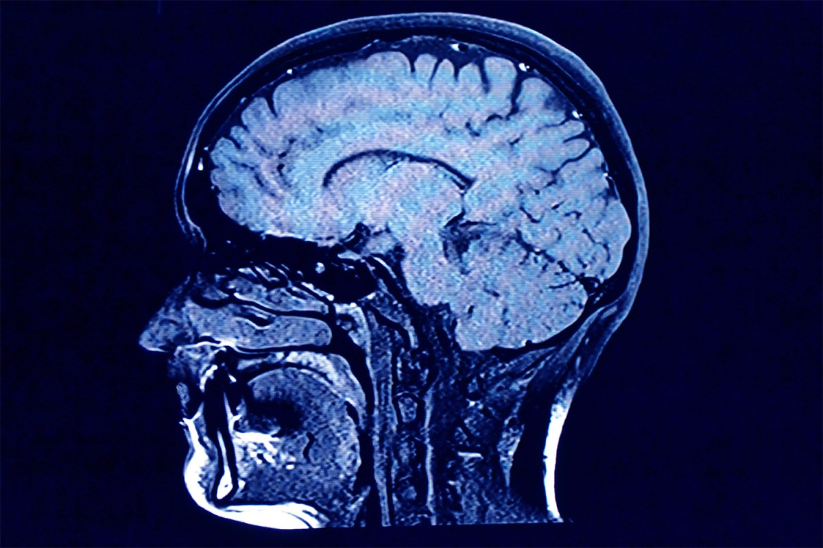 Creatine for Brain Health: Boost Memory, Energy and Clarity