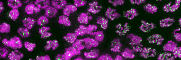 Meiotic crossover recombination 