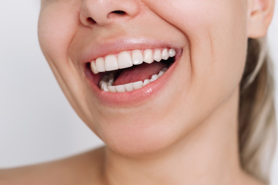 Close-up of a woman smiling, showing healthy white teeth.