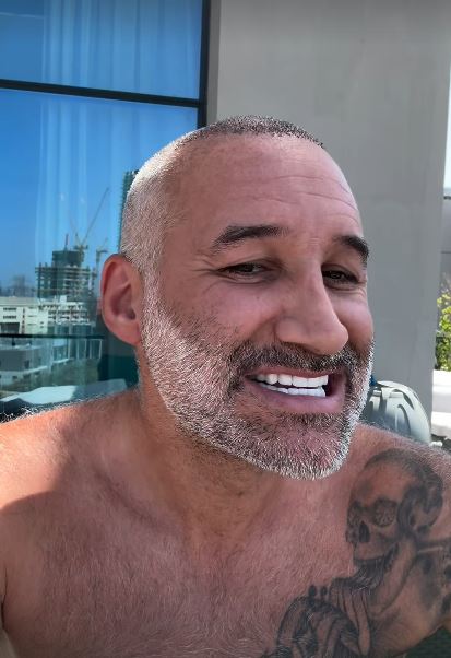 Close-up of Dane Bowers showing off his new teeth.