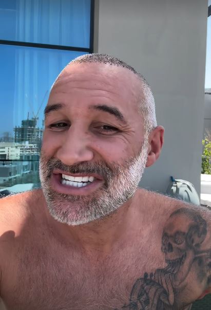 Close-up of Dane Bowers showing off his new teeth.