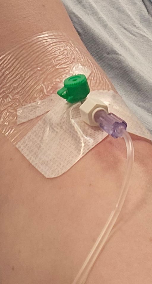 IV drip in a patient's arm.