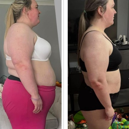 Before and after weight loss photos.