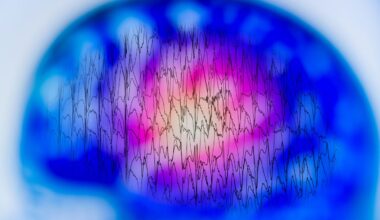 Genetic Mutations Leading to Epilepsy Disorder Identified
