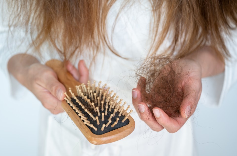Woman holding a hairbrush and a clump of hair, showing hair loss.