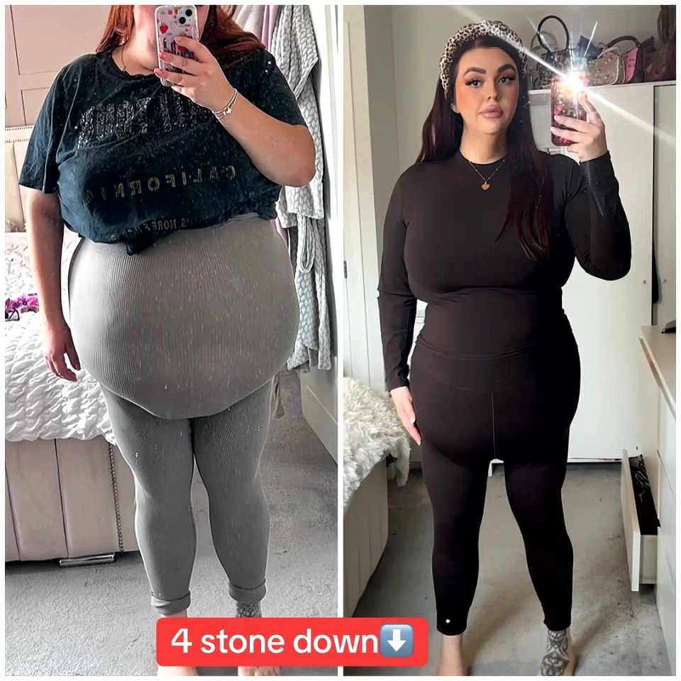 Before and after photos showing a woman's weight loss of 4 stone.