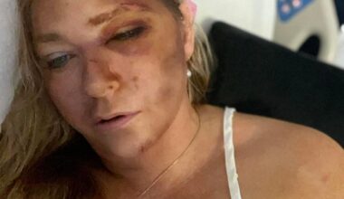 Andrew accuser Virginia Giuffre's injuries 'may not have all been caused by crash' as mystery deepens on shock post