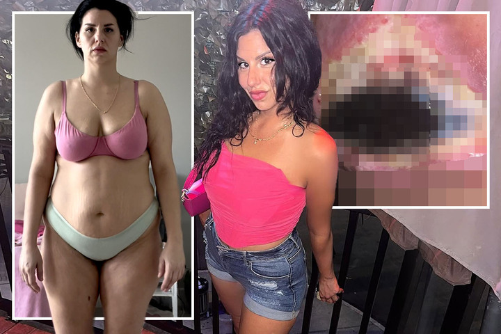 My flesh turned BLACK and rotted away after botched £19,000 mummy makeover - I've been left permamently deformed