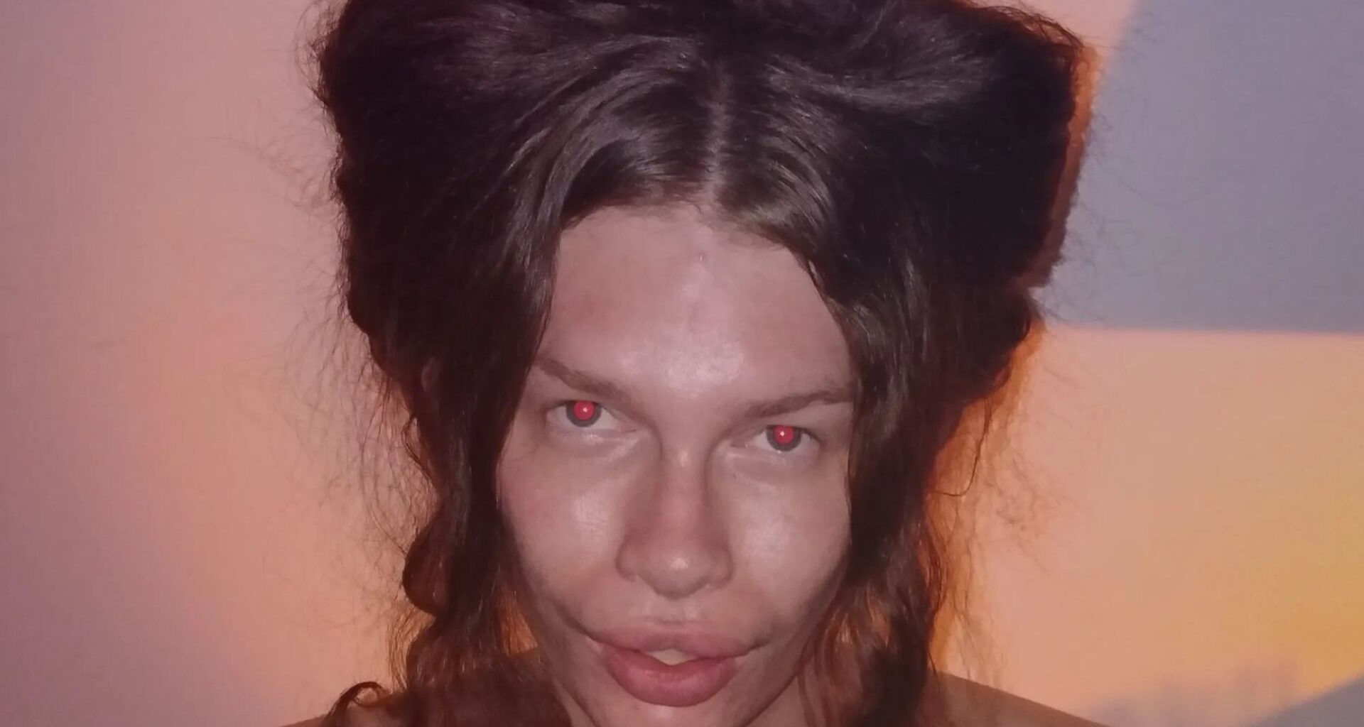 I spent £6k on surgery to look like a CAT & regret it - I’m in agony & it stops from me being able to speak properly