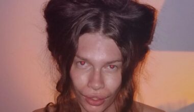 I spent £6k on surgery to look like a CAT & regret it - I’m in agony & it stops from me being able to speak properly