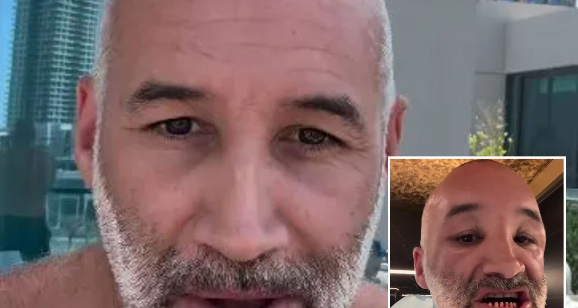 Dane Bowers reveals new Turkey Teeth after having them shaved down to pegs for makeover