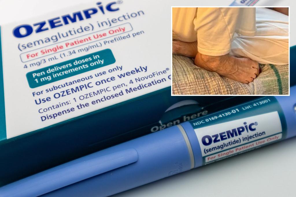 'Ozempic feet' gnarly side effect of weight loss drug exhibited by some celebs: report