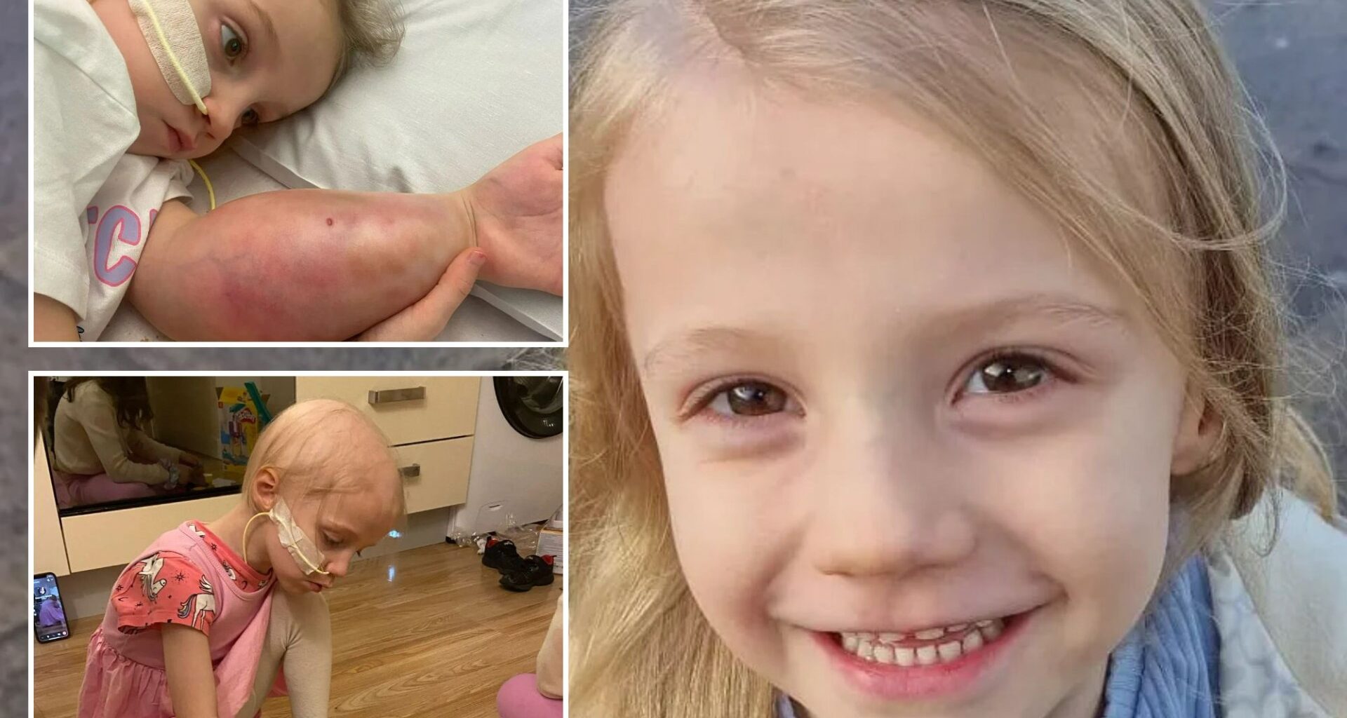 Our Bonnie’s ‘broken arm’ turned out to be killer cancer - now she has less than a year to live, she's only 5