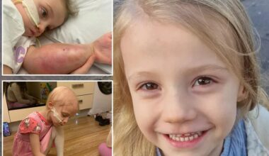 Our Bonnie’s ‘broken arm’ turned out to be killer cancer - now she has less than a year to live, she's only 5