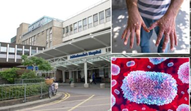 Major hospital issues warning after person with mpox visits A&E - as it rushes to identify patients and staff exposed