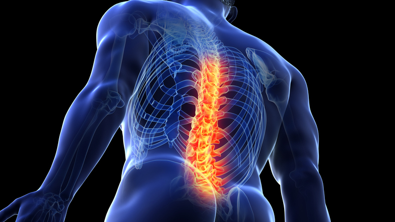 Illustration of lower back pain.