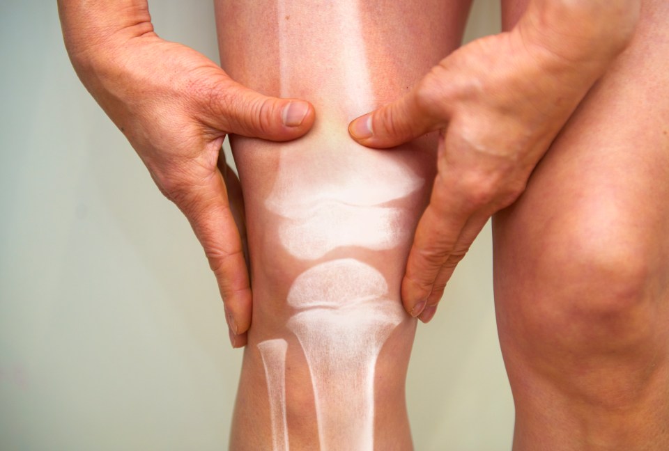 Person's hands on injured knee with superimposed x-ray showing bone structure.