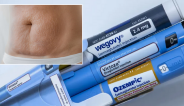 Ozempic side effect leaves weight-loss drug users looking like 'melted candles'... and it affects young people too