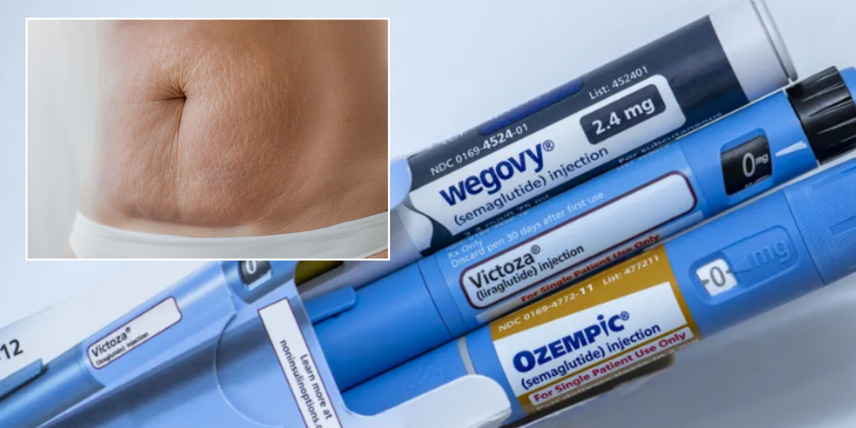 Ozempic side effect leaves weight-loss drug users looking like 'melted candles'... and it affects young people too