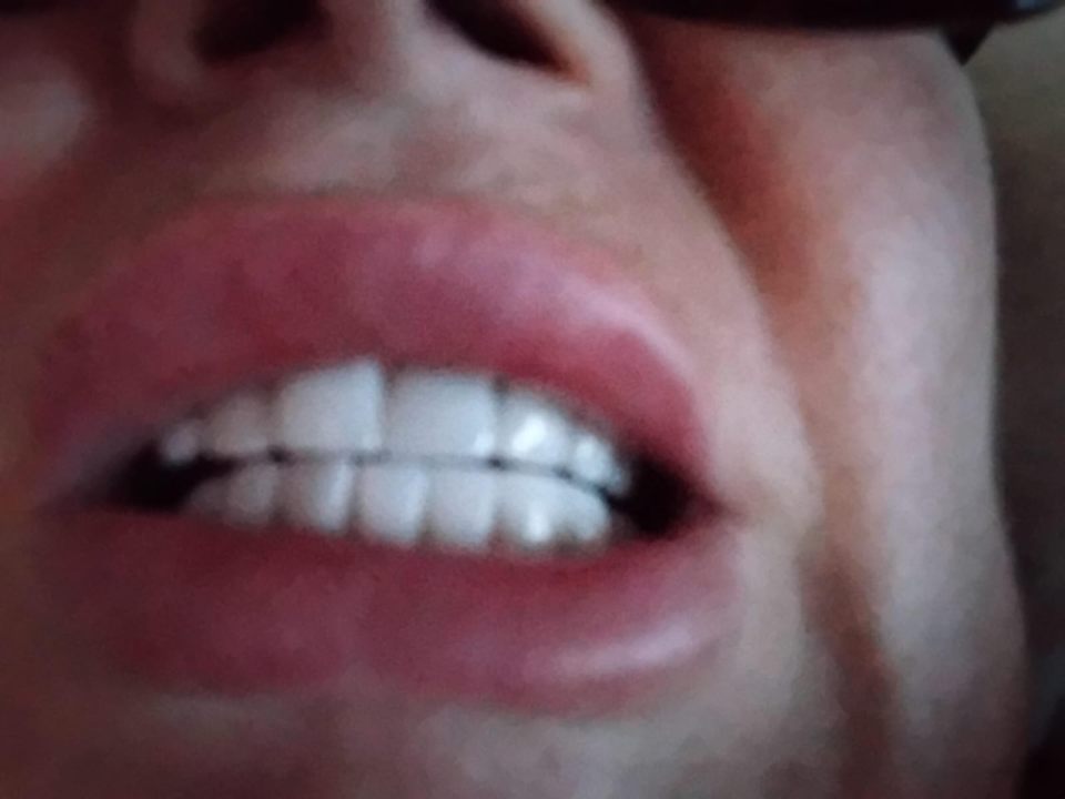 Close-up of a person's teeth.