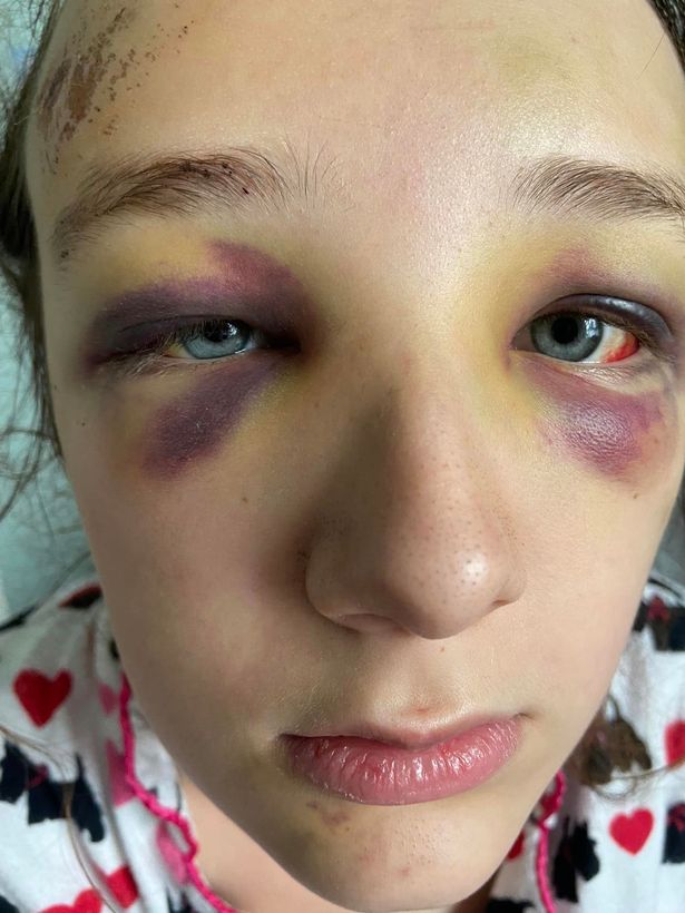 Abbie in hospital after her attack