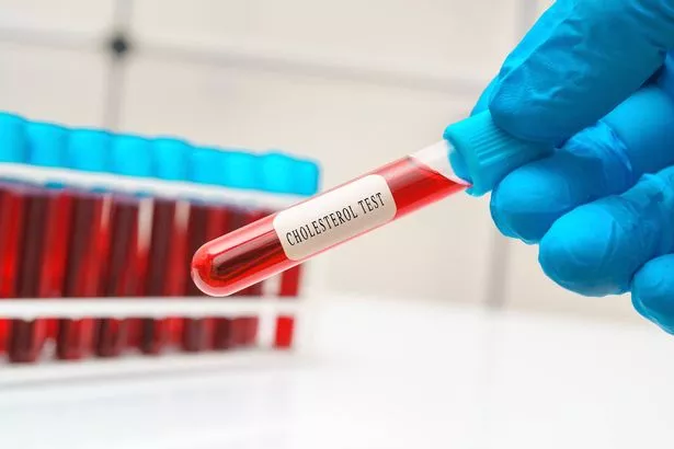 Cholesterol blood test, conceptual image.