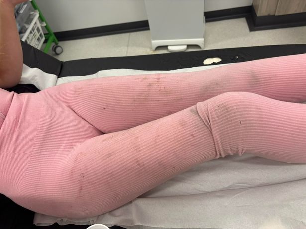 Caitlin's leggings were muddy and ripped following the attack