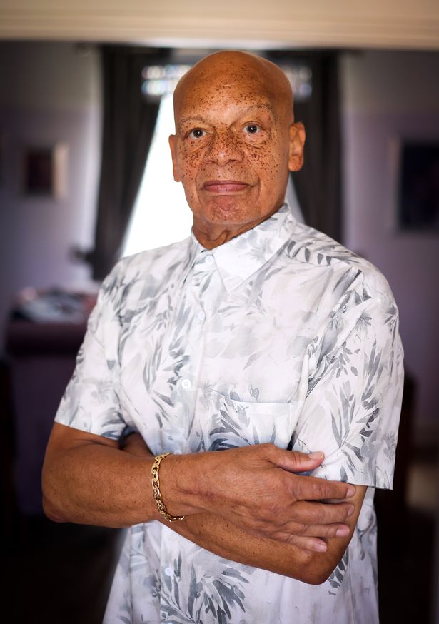 Michael Showers pictured at home in Liverpool