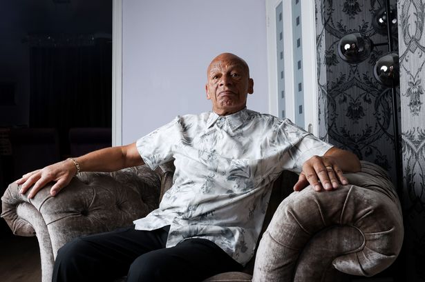 Michael Showers pictured at home in Liverpool