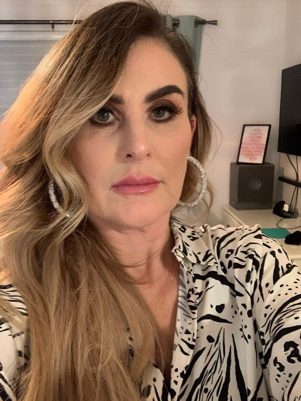Karyn says the creams 'ruined her life.'