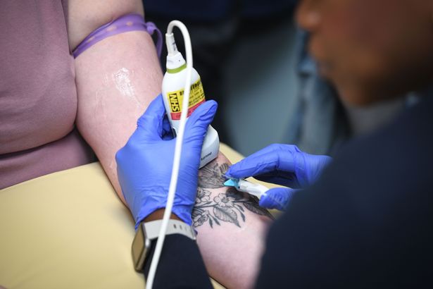 A Bristol NHS team has been used as a blueprint for the roll out of a service that means fewer patients need surgery, improving patient experience and saving the NHS money