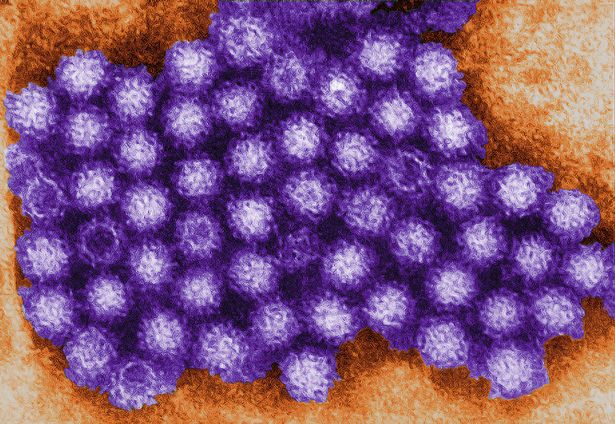  Undated handout file photo issued by the Centers for Disease Control and Prevention of the Norovirus virons 