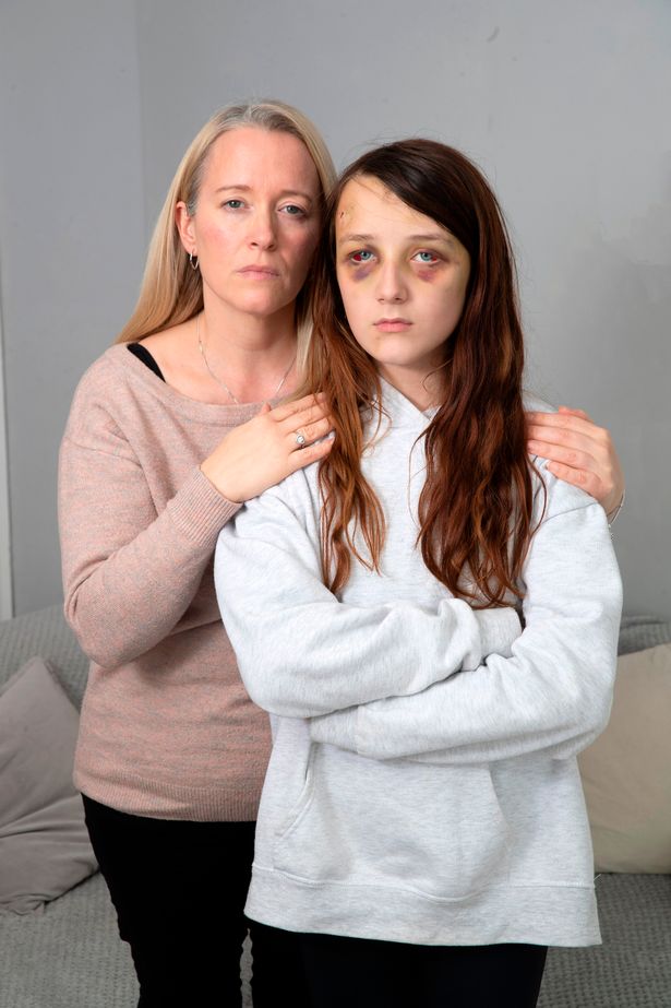 Abbie pictured with her mum a week after the attack