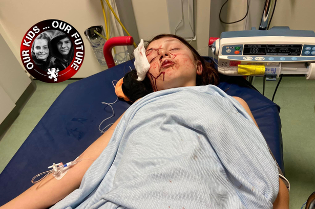 Abbie was in hospital for several days after the beating in October 2022